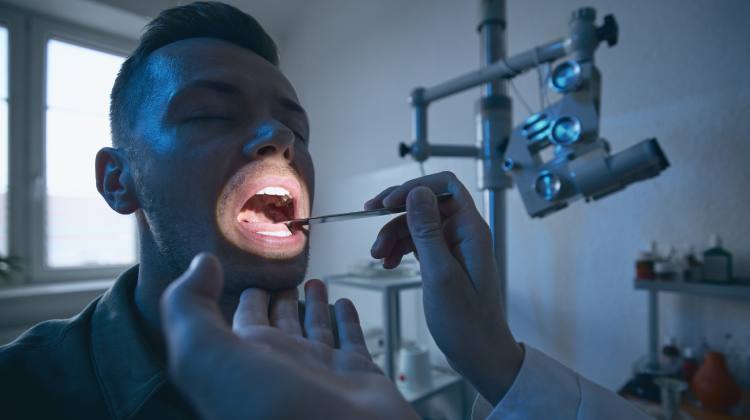 tratamiento para Pólipos de laringe  Otorrinolaringólogo en Naucalpan