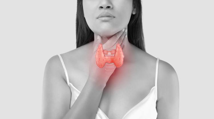 tratamiento para Amigdalitis Otorrinolaringólogo en Naucalpan