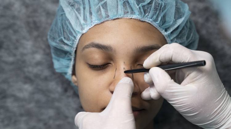 Rinoplastia estética y funcional Otorrinolaringólogo en Naucalpan