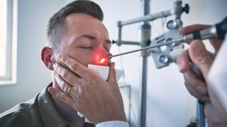 tratamiento para Tumores nasales Otorrinolaringólogo en Naucalpan