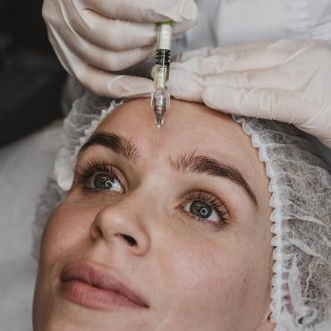 Aplicación de toxina botulínica en Naucalpan