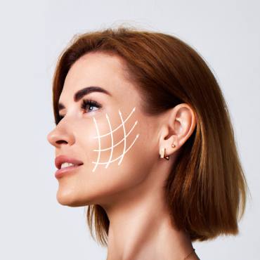 Bichectomía en Naucalpan